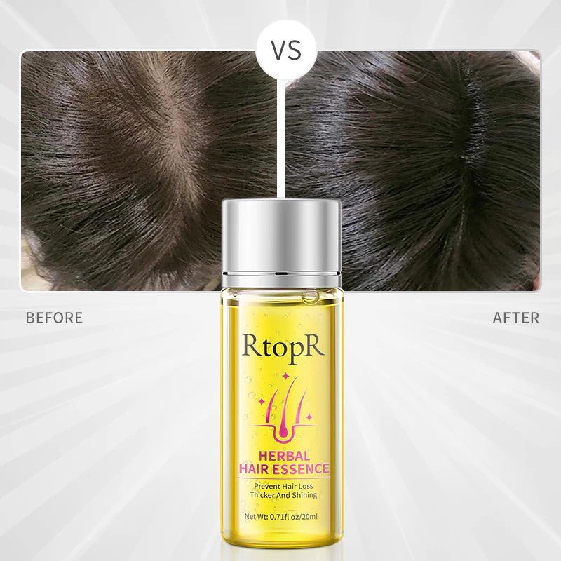 RtopR Hair Essence