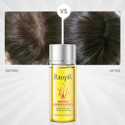 RtopR Hair Essence