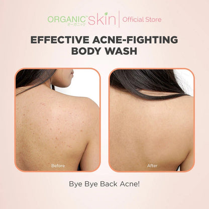 Organic Skin Japan Acne Care Bacne Body Wash 250ml