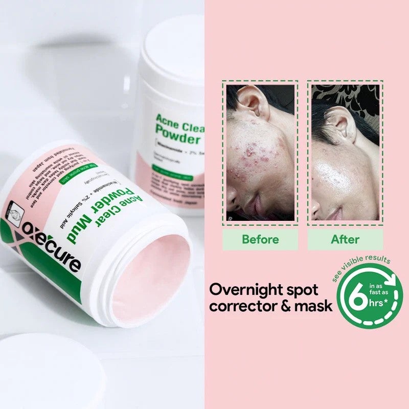 Oxecure Mud 5g
