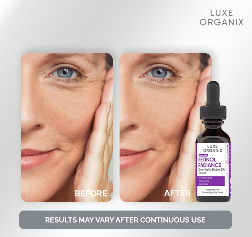 Luxe Organix ClinicalPro Retinol Radiance Overnight Botox Lift Serum 30ml