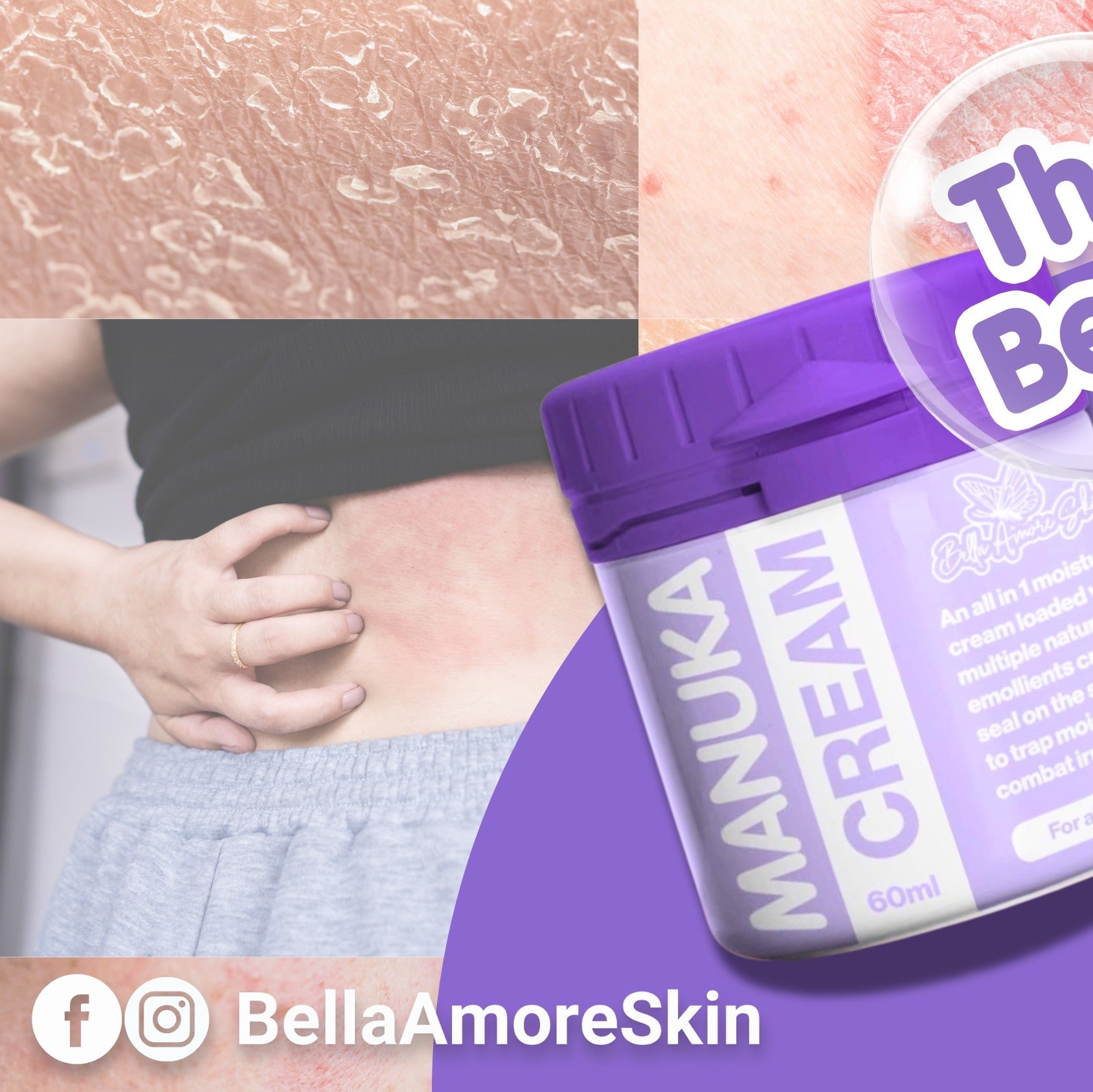 Bella Amore Skin Manuka Cream 60ml