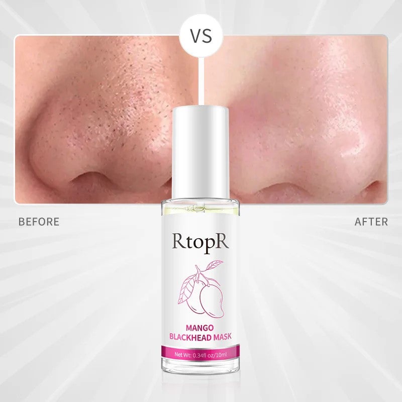 RtopR Blackhead Remover