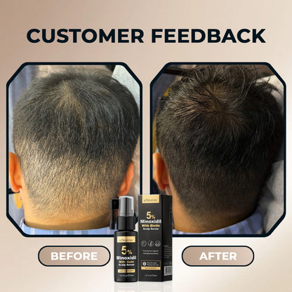 Kormesic Minoxidil with Biotin Scalp Serum 30 ml