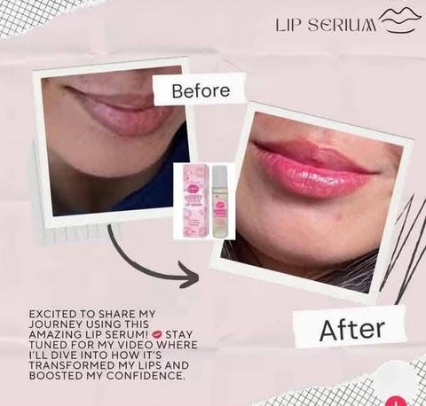 K Beauty Lip Serum