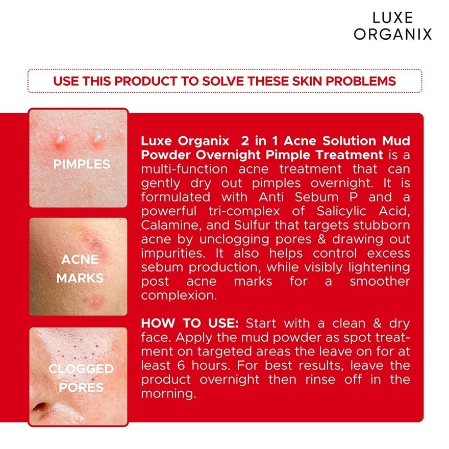 LUXE ORGANIX 2 in 1 Acne Solution Mud Powder Overnight Pimple Treatment 9g