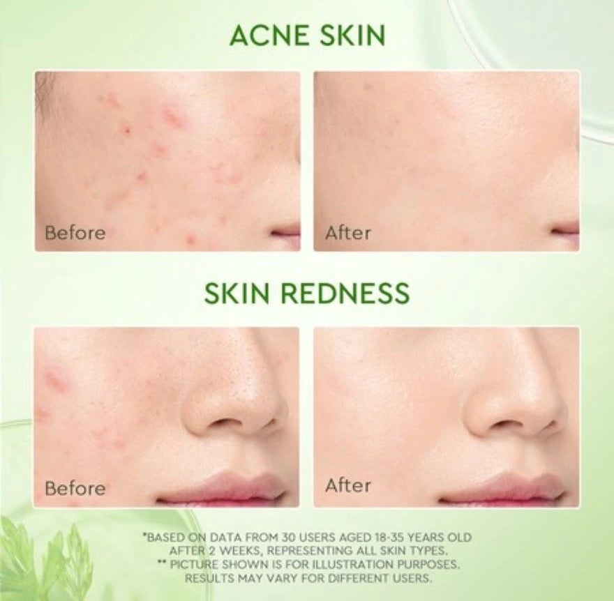 Glad2Glow Mugwort Salicylic Acid Acne Clay Stick 25g