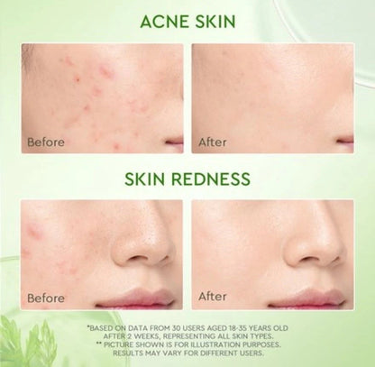 Glad2Glow Mugwort Salicylic Acid Acne Clay Stick 25g